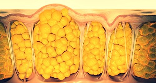 Masajeador anticelulítico TESMED Cell: masajea la celulitis gracias a los rodillos patentados