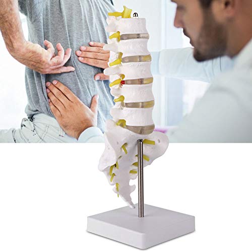 Modelo de Anatomía de Columna Lumbar,Modelo Científico de Mini Columna Vertebral de 12,6"Detalles de Vértebras, Sacro, Cuerpo, Cinco Secciones, Vértebras Lumbares, Disco Blando, para Didáctica de