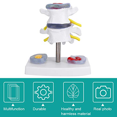 Modelo de vértebras lumbares humanas, modelo de esqueleto anatómico humano Modelo de vértebras lumbares con base extraíble Fácil de instalar Ayuda a las personas a controlar el estado de la columna