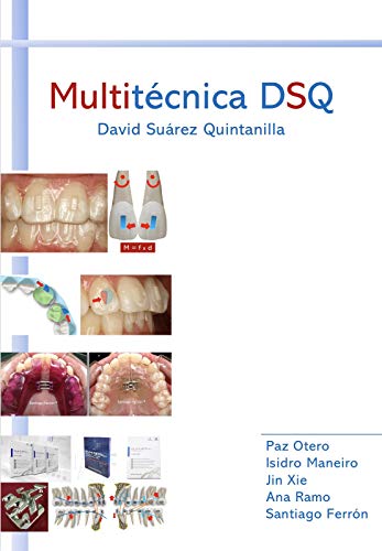 Multitécnica de Ortodoncia DSQ: El futuro de la Ortodoncia