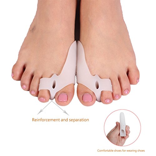 Ndier 8PCS/Set Hallux Valgus Corrector Separador de dedos del pie Alivio del dolor Cuidado del pie de los juanetes de la salud belleza