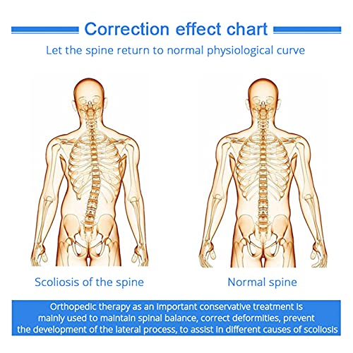 Órtesis de Columna Vertebral Corrector de Postura Ajustable Corrector de Postura de Escoliosis para la Recuperación Postoperatoria de la Espalda