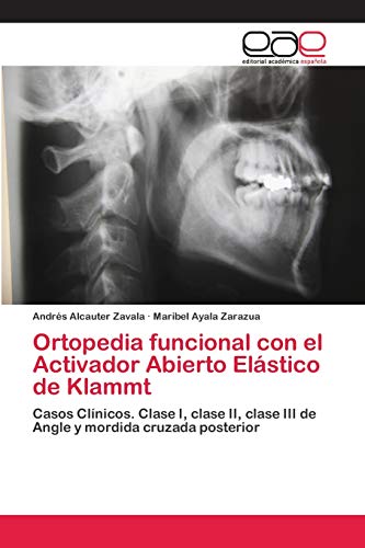 Ortopedia funcional con el Activador Abierto Elástico de Klammt: Casos Clínicos. Clase I, clase II, clase III de Angle y mordida cruzada posterior