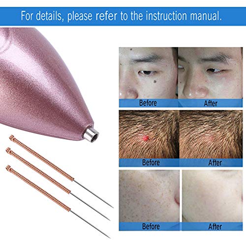 Paquete de 10 Agujas de eliminación de manchas de acero inoxidable Pecas oscuras Removedor de lunares Mole Espinilla Extractor de pasadores Pin Cleaner Tool