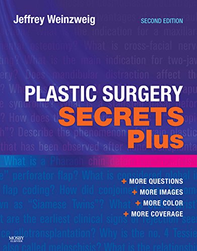 Plastic Surgery Secrets Plus (English Edition)