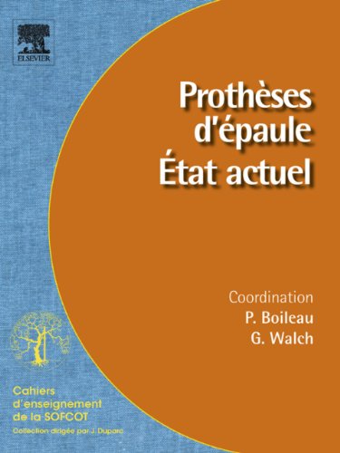 Prothèses d'épaule. État actuel (Cahiers d'enseignement de la SOFCOT) (French Edition)