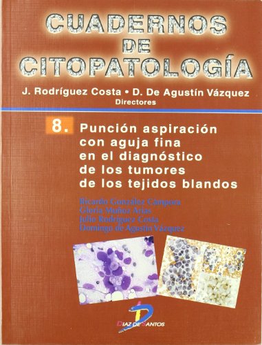 Punción aspiración con aguja fina en el diagnósitco de los tumores de los tejidos blandos: Cuadernos de citopatologia-8