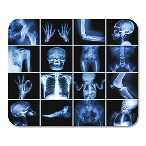 Rae Esthe Gaming Mouse Pad Colección de Rayos Parte múltiple de Rayos X Humanos Bone Hospital Decoración ortopédica Oficina Antideslizante Respaldo de Goma Mousepad Alfombrilla de ratón