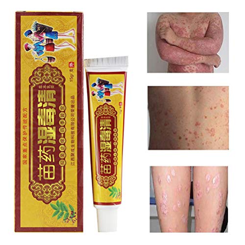 Rlevolexy Crema de hierbas, 15g de hongos anti bacteriano crema natural de hierbas chinas crema ungüento para la psoriasis dermatitis Eccema tratamiento