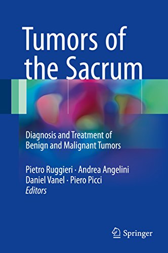 Tumors of the Sacrum: Diagnosis and Treatment of Benign and Malignant Tumors (English Edition)