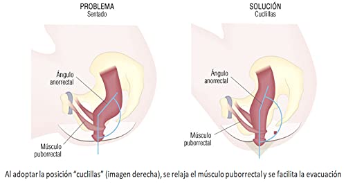 Vivefit Taburete Fisiológico para Inodoro. Ayuda a una Mejor Deposición, a Prevenir Hernia Inguinal, Estreñimiento y Hemorroides. Postura Natural para Mujeres y Hombres. Antideslizante.