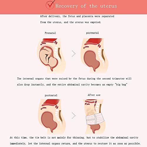 WILLQ Banda para el Vientre Postparto y recuperación de la Cintura Postparto/Cintura/Pelvis Fajas para cinturón Faja Adelgazante Transpirable