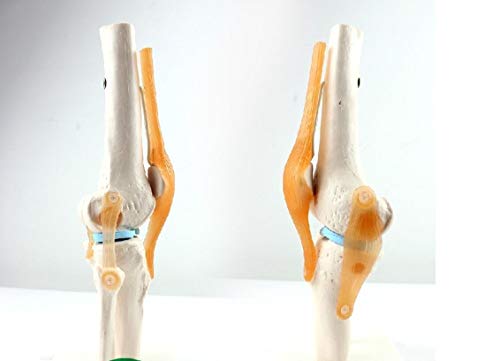 XIOFYA Palabra Clave 1pc: Enseñanza ortopédica;Modelo de Rodilla;Modelo de ligamento de Rodilla;