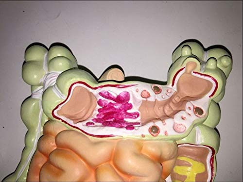 ZYYH Modelo de lesión colorrectal Humana, Modelo del tracto gastrointestinal, réplica de la anatomía del Cuerpo Humano del Sistema digestivo para médicos, Herramienta educativa de Oficina.