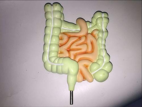 ZYYH Modelo de lesión colorrectal Humana, Modelo del tracto gastrointestinal, réplica de la anatomía del Cuerpo Humano del Sistema digestivo para médicos, Herramienta educativa de Oficina.