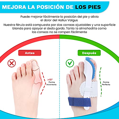 2 Corrector de Juanetes Dedos del Pie- Férula para Juanetes Nocturna- Corrector Hallux Valgus- Corrector Dedos Pie- Alivio Dolor Dedos Pie- Para hombres y Mujeres