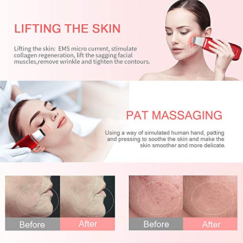 ANLAN Peeling Ultrasónico Facial con 5 Modos, LCD Pantalla, USB Recargable, Equipo de Belleza Facial Multifuncional para Limpieza Facial y Cuidado Facial