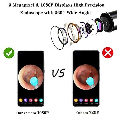 BEBIRD R1 Otoscopio, Eliminación de cera de oído con endoscopio Endoscopio Camara with 1080P FHD Kit de Limpieza de Oídos para Eliminación de Cerumen para iPhone, Tabletas y Android（Negro）