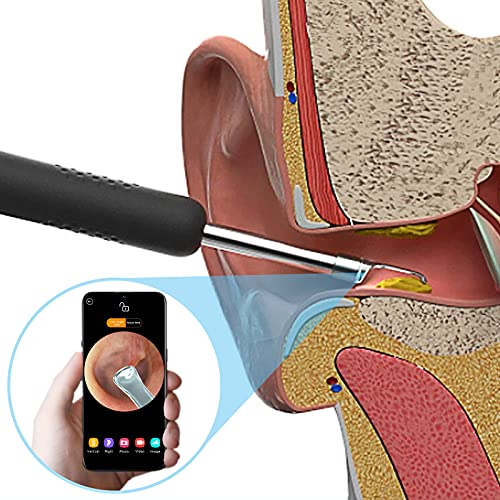 BEBIRD R1 Otoscopio, Eliminación de cera de oído con endoscopio Endoscopio Camara with 1080P FHD Kit de Limpieza de Oídos para Eliminación de Cerumen para iPhone, Tabletas y Android（Negro）