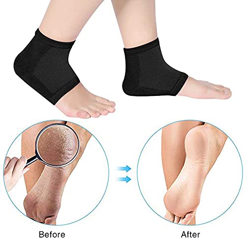 Calcetines para el talón, vendaje para el tobillo, para aliviar el dolor de la fascitis plantar, dedos abiertos, suaves y cómodos, para hombres y mujeres (negro)