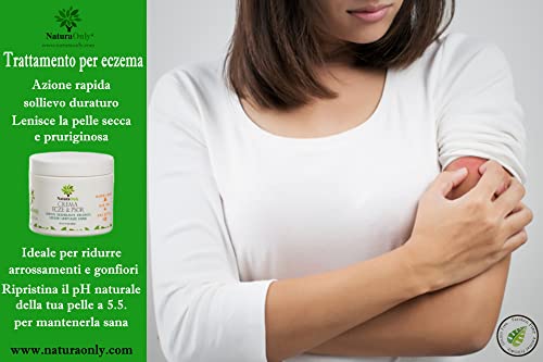 Crema para eccema y psoriasis Natura Only, para pieles secas e irritadas, alivio de picazón, dermatitis, rosácea y culebrilla (fuego de San Antonio).