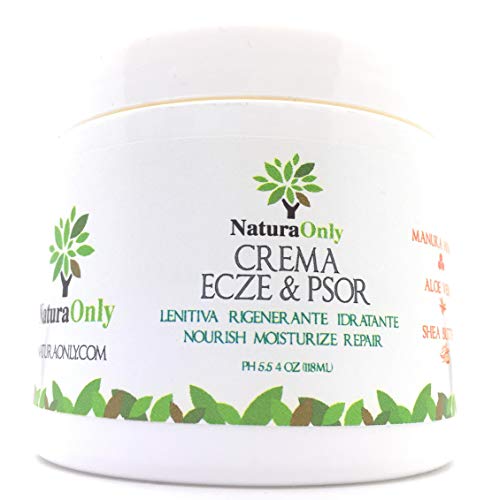 Crema para eccema y psoriasis Natura Only, para pieles secas e irritadas, alivio de picazón, dermatitis, rosácea y culebrilla (fuego de San Antonio).