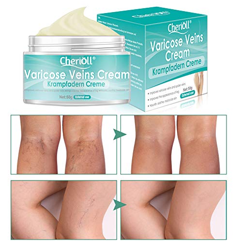 Crema para Varices, circulación sanguínea en las piernas, Crema para venas varicosas, alivio de flebitis, angiitis, inflamación de vasos