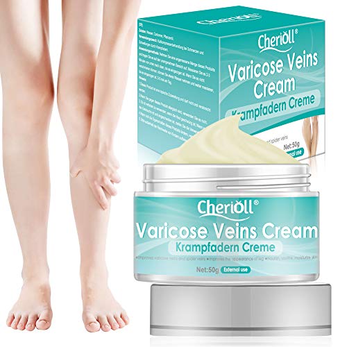 Crema para Varices, circulación sanguínea en las piernas, Crema para venas varicosas, alivio de flebitis, angiitis, inflamación de vasos