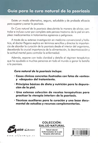 Cura Natural De La Psoriasis: La terapia alternativa, segura, saludable y de eficacia probada (Salud natural)