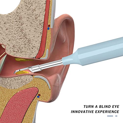 DUTUI Eliminación De Cera De Oídos-Removedor De Cera De Oídos Limpiador De Cera De Oídos con Tapones para Los Oídos WiFi Inalámbricos 1080P HD Kit De Eliminación De Cera De Oídos Endoscopio,Negro