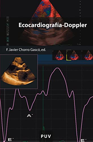 Ecocardiografía-Doppler (Educació. Sèrie Materials nº 114)