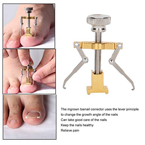 Juego de herramientas de pedicura de 8 piezas, corrector de uñas encarnadas parche autoadhesivo para uñas de los pies parches para uñas encarnadas pegatinas herramienta de cepillado