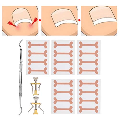 Juego de herramientas de pedicura de 8 piezas, corrector de uñas encarnadas parche autoadhesivo para uñas de los pies parches para uñas encarnadas pegatinas herramienta de cepillado