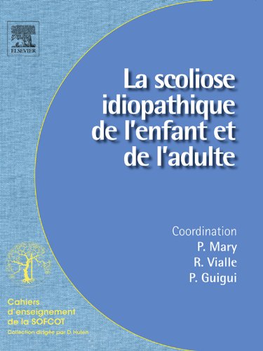 La scoliose idiopathique de l'enfant et de l'adulte (Cahiers d'enseignement de la SOFCOT) (French Edition)