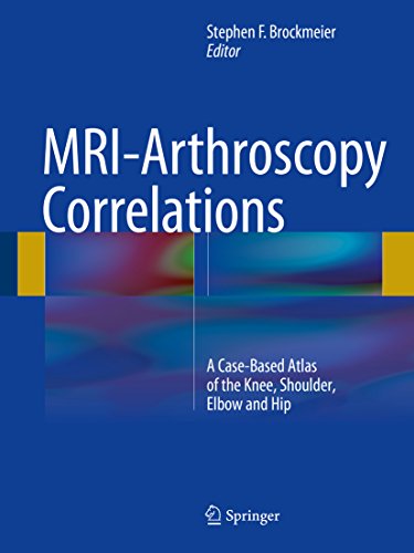 MRI-Arthroscopy Correlations: A Case-Based Atlas of the Knee, Shoulder, Elbow and Hip (English Edition)