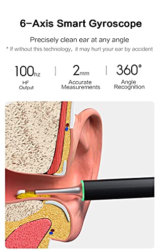 Otoscopio BEBIRD X17 Pro, Endoscopio Eliminación de cera de oído，con Endoscopio Camara with 1080P FHD Kit de Limpieza de Oídos para Eliminación de Cerumen para IOS y Android-Negro