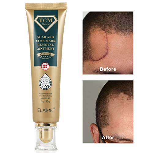 Scar Gel de Cicatriz, Gel de Eliminación de Cicatrices, Cicatrices Tratamiento, Cicatrices Crema, Tratar y Reducir Cicatrices para Rostro, Cuerpo, Estrías, Cesáreas, Quemaduras