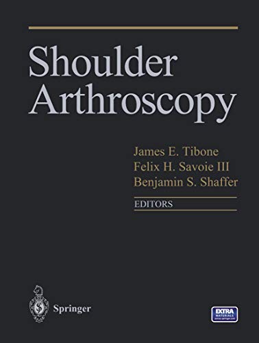 Shoulder Arthroscopy (English Edition)