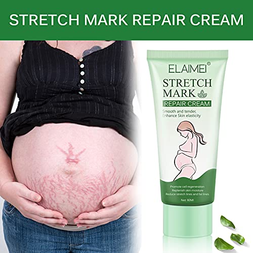 Thnkstaps Anti Stretch Mark Crema Antiestrías Crema para estrías Eliminar cicatrices del embarazo Tratamiento de las estrías Reparación de maternidad Eliminar estrías 60g