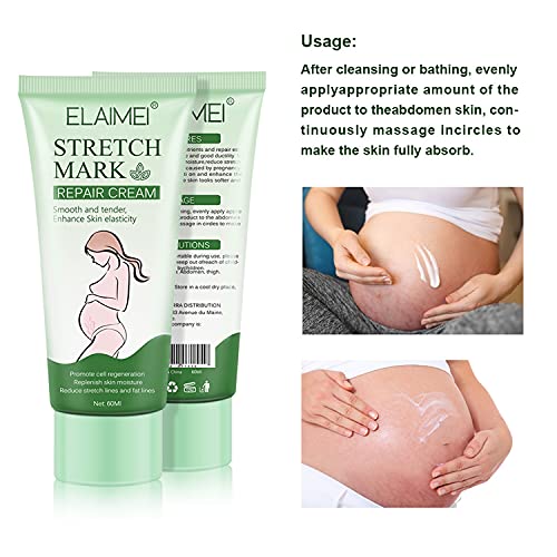 Thnkstaps Anti Stretch Mark Crema Antiestrías Crema para estrías Eliminar cicatrices del embarazo Tratamiento de las estrías Reparación de maternidad Eliminar estrías 60g