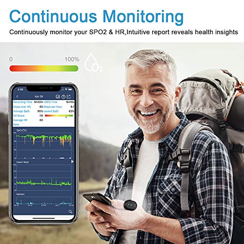 ViATOM Oxímetro de Pulso, Oxygen Monitor Bluetooth, Medición de la saturación de oxígeno (SPO₂), Frecuencia Cardíaca (Pulso), con Alarma, App para Android e iOS, Reporte de PC