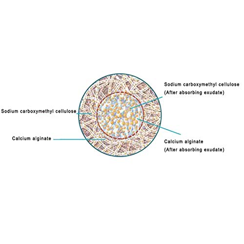 WSN Apósito de alginato de Calcio, El apósito quirúrgico para fístula Anal se Utiliza para Rellenar la Herida de la cavidad sinusal Úlcera por presión Úlcera por presión,10pcs
