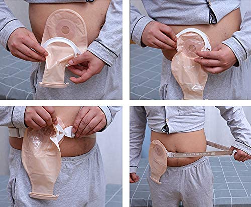 YUXINCAI Ostomía Abdominal Binder Brace Soporte De Cintura Use En El Estoma Abdominal para Arreglar La Bolsa - Cinturón De Hernia Abdominal Transpirable Banda para El Vientre para Hombre Y Mujer