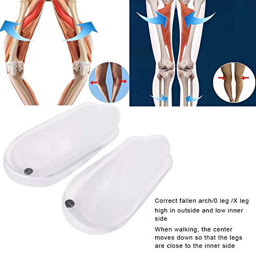 1 par Supinación y sobre-pronación Inserciones correctivas del zapato Corrección O/X Tipo Inserciones del zapato de la pierna Plantillas de soporte del arco Suela del zapato del talón(Child use)