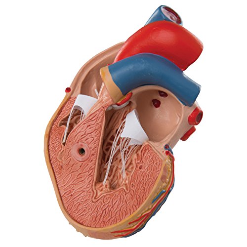 3B Scientific G04 Corazón Clásico Con Hipertrofia Ventricular Izquierda (Hvi), de 2 Piezas - 3B Smart Anatomy