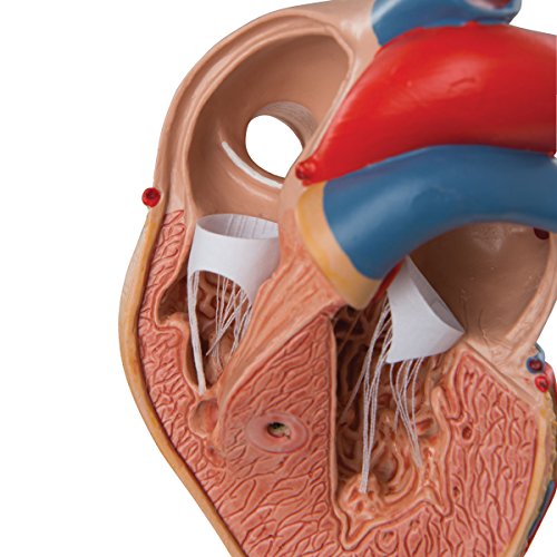 3B Scientific G04 Corazón Clásico Con Hipertrofia Ventricular Izquierda (Hvi), de 2 Piezas - 3B Smart Anatomy