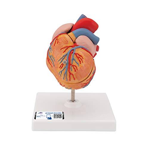 3B Scientific G04 Corazón Clásico Con Hipertrofia Ventricular Izquierda (Hvi), de 2 Piezas - 3B Smart Anatomy