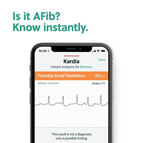 AliveCor, Kardia Mobile