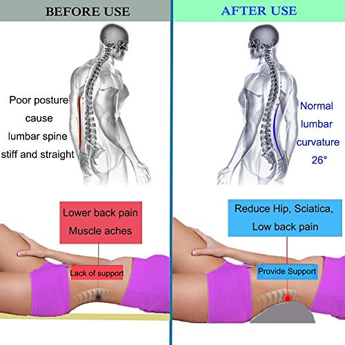Almohada para escoliosis con rollo lumbar, soporte lumbar de cadera para cama, almohada de apoyo para la parte inferior de la espalda