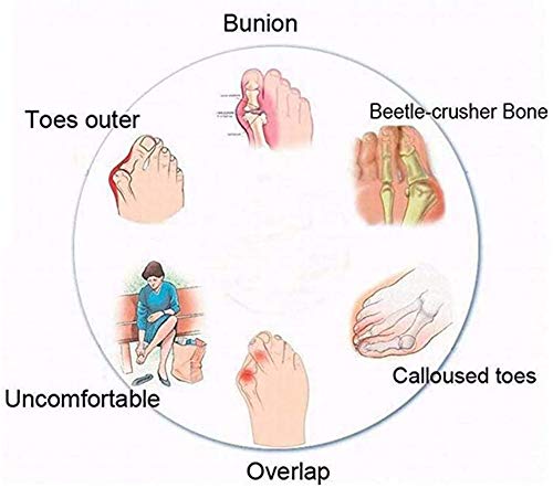 BABYS'q Sandalias de corrección de Hueso de Dedo Gordo para Mujer, Sandalias ortopédicas de juanete Corrector con Soporte de Arco Zapatillas Romanas Casuales de Suela Gruesa,Marrón,39